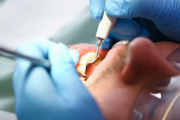 Best Emergency TMJ Treatment in Fairfield Bay, AR
