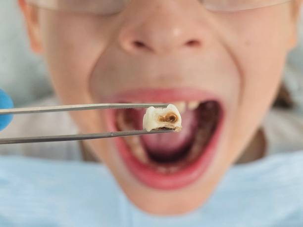 Best Weekend Emergency Dentist in Fairfield Bay, AR